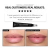 Revision YouthFull Lip Replenisher Odmładzające serum do ust 9.4 g