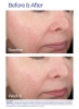 ZO Skin Health Rozatrol Kuracja dla zaczerwienionej, uwrażliwionej skóry 20 ml