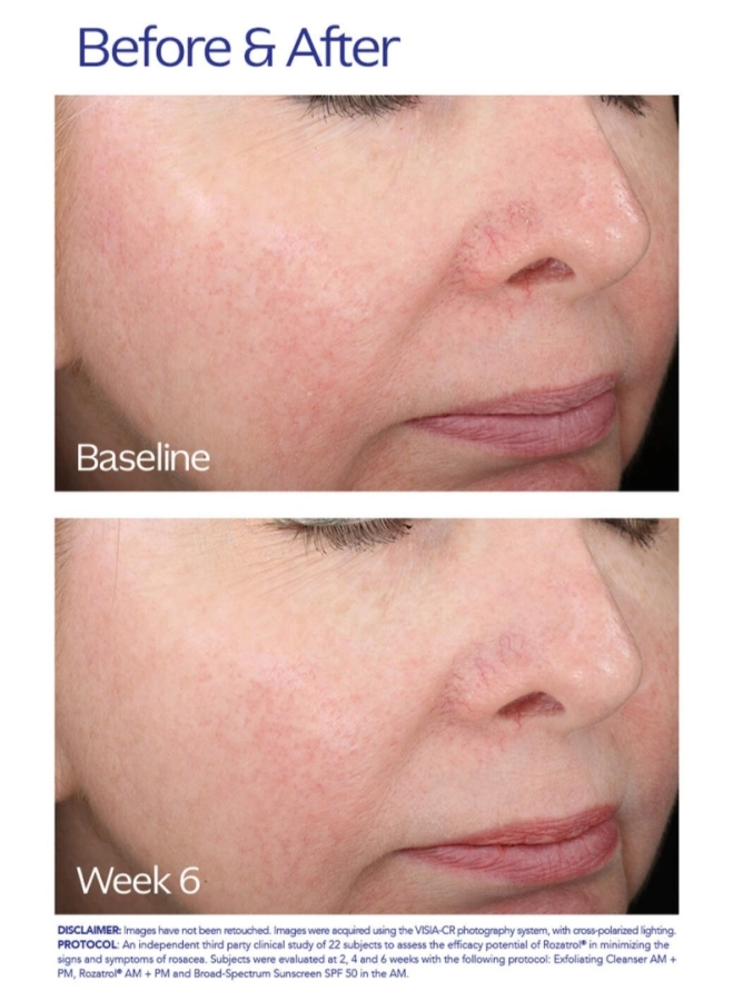 ZO Skin Health Rozatrol Kuracja dla zaczerwienionej, uwrażliwionej skóry 20 ml