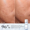 Medik8 Press & Clear Tonik dla skór z niedoskonałościami 30 ml
