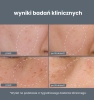 Dermalogica PowerBright Dark Spot System Serum likwidujące przebarwienia 30 ml + Peeling redukujący przebarwienia 50 ml