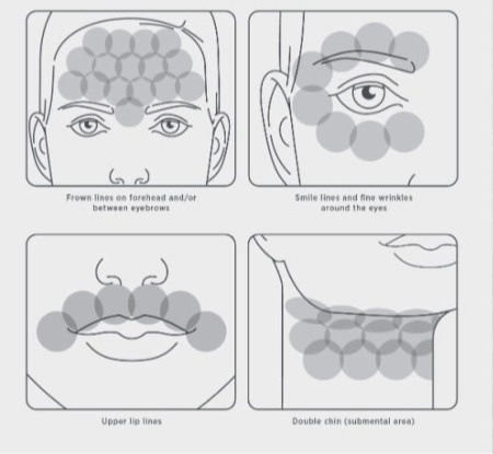 Environ DF Mobile Device Stymulujące, nieinwazyjne urządzenie na zmarszczki i przebarwienia