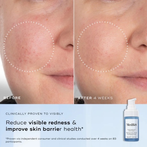 Medik8 Niacinamide Peptides Serum Serum z 10% niacynamidem, peptydami i NAG 30 ml