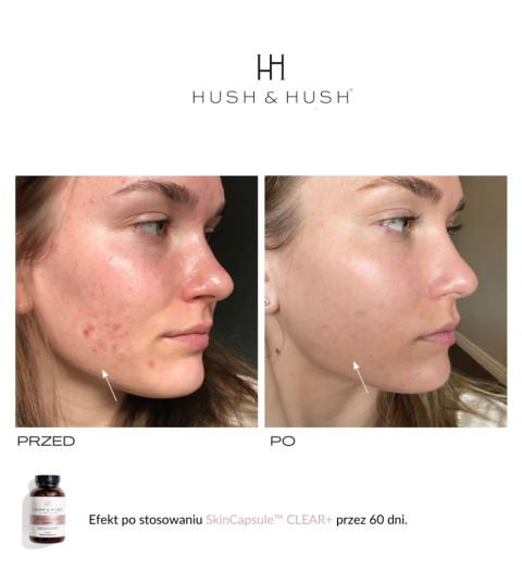 HUSH&HUSH Skin Capsule Clear+ Czysta cera 60 kaps.