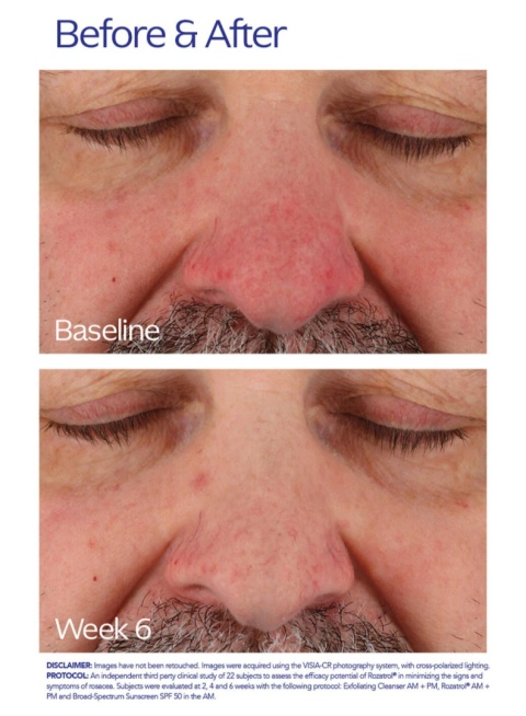 ZO SKIN HEALTH Rozatrol NEW Kuracja dla zaczerwienionej, uwrażliwionej skóry 20 ml