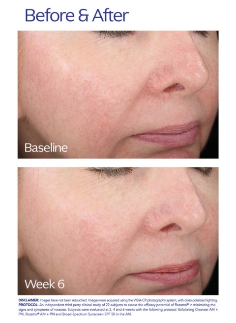 ZO SKIN HEALTH Rozatrol NEW Kuracja dla zaczerwienionej, uwrażliwionej skóry 20 ml