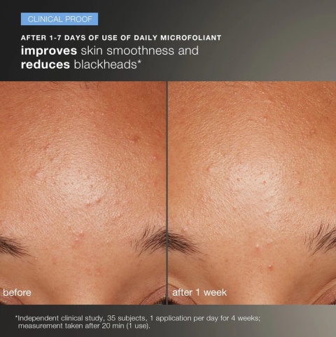 Dermalogica Discover Healthy Skin Kit -  Healthy Skin Kit